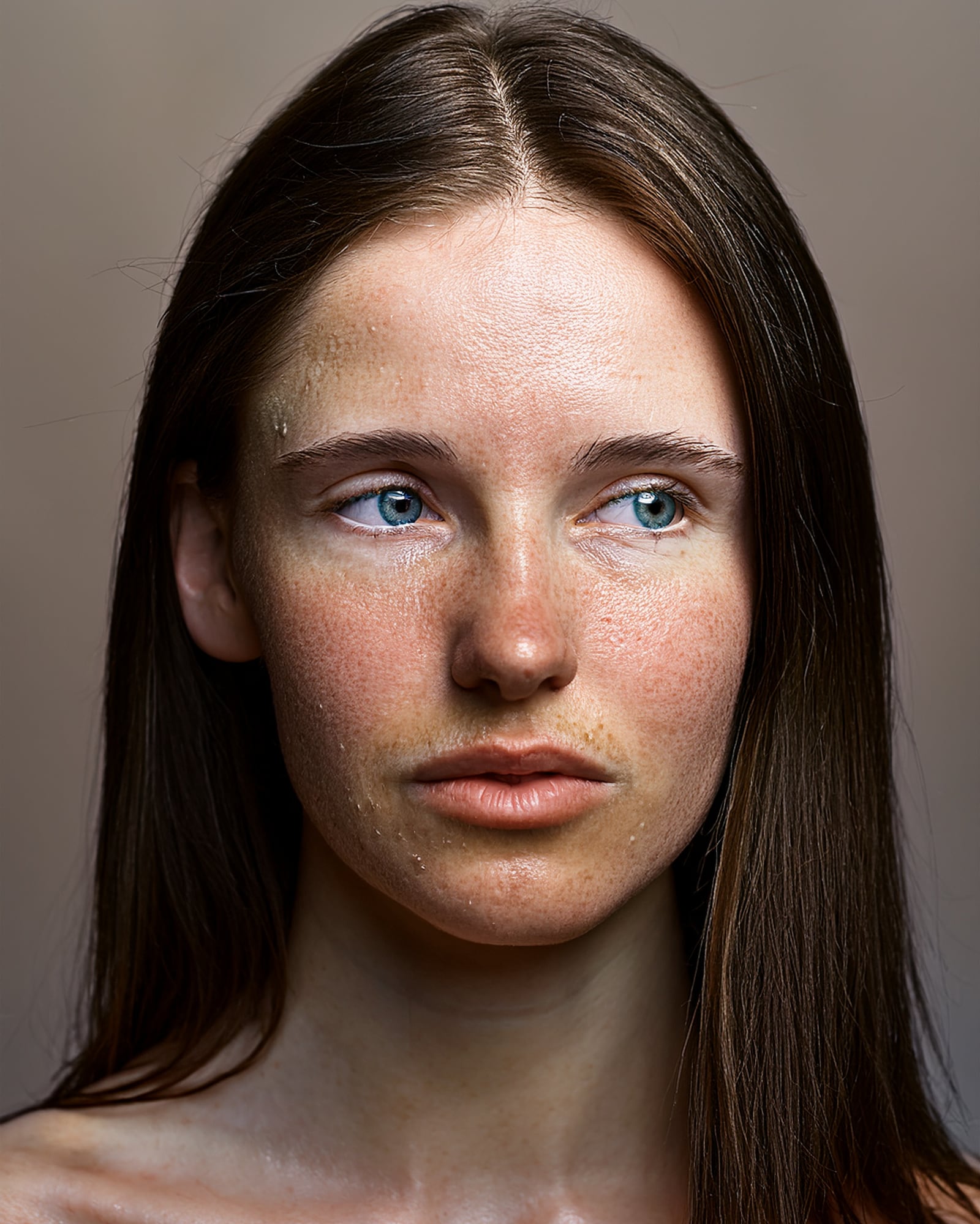 A woman photographed in flat daylight against plain plaster, her skin looking dull and dry with flaking around the mouth.